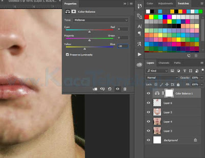 Bagaimana Cara Menghilangkan Jerawat di Photoshop dalam waktu 3 menit - Menghilangkan jerawat menggunakan Adobe Photoshop sangatlah mudah dan hal ini bisa dilakukan dalam waktu yang singkat. Cara ini juga sekaligus membahas tentang cara menghaluskan wajah di Photoshop. Adapun tools yang digunakan untuk menghilangkan jerawat dan menghaluskan wajah adalah menggunakan Spot Healing Brush Tool, Smudge Tool, Clone Stamp Tool, Blur dan sedikit gradiasi warna.