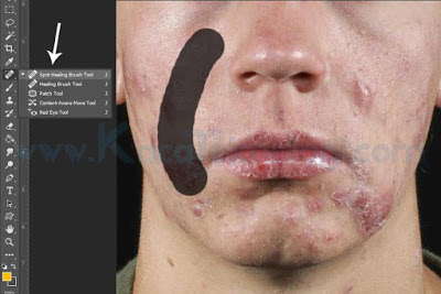 Bagaimana Cara Menghilangkan Jerawat di Photoshop dalam waktu 3 menit - Menghilangkan jerawat menggunakan Adobe Photoshop sangatlah mudah dan hal ini bisa dilakukan dalam waktu yang singkat. Cara ini juga sekaligus membahas tentang cara menghaluskan wajah di Photoshop. Adapun tools yang digunakan untuk menghilangkan jerawat dan menghaluskan wajah adalah menggunakan Spot Healing Brush Tool, Smudge Tool, Clone Stamp Tool, Blur dan sedikit gradiasi warna.